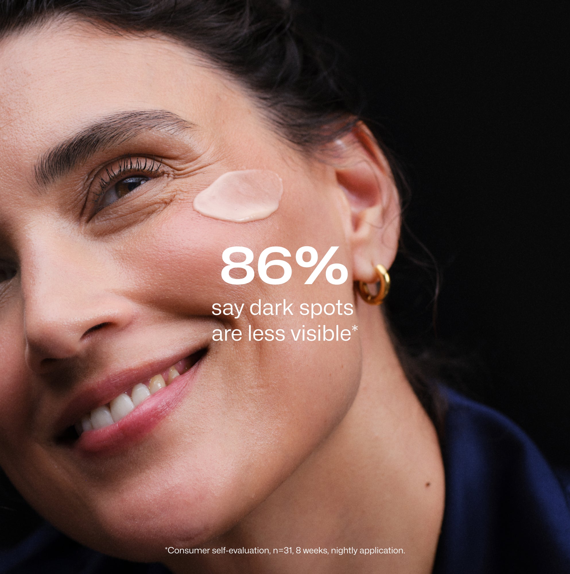 Silottava & pigmenttiläiskiä häivyttävä yöseerumi