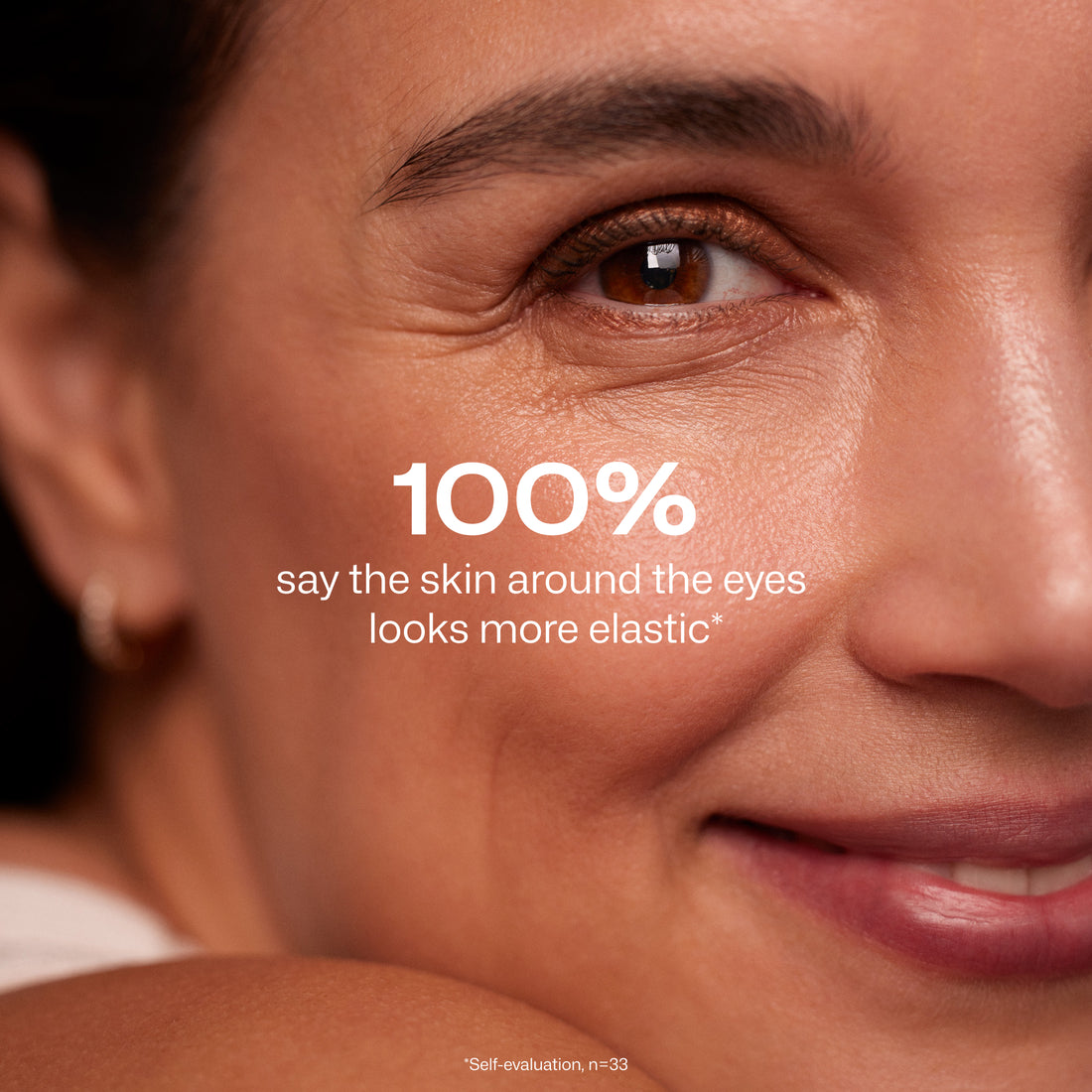 Kimmoisuutta lisäävä silmänympärysseerumi